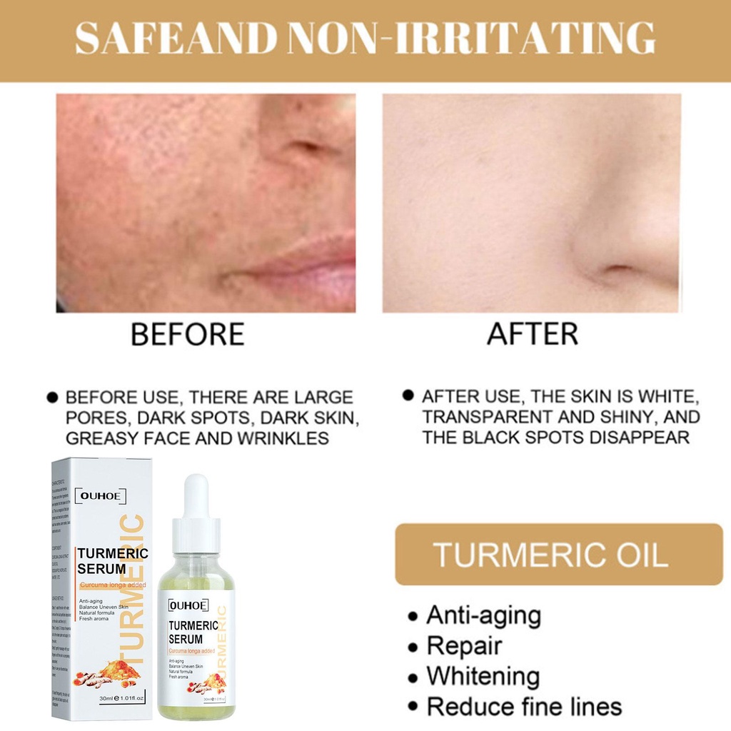 Tinh Chất Phục Hồi Da Chống Nếp Nhăn Làm Mờ Vết Thâm OUHOE T8M7