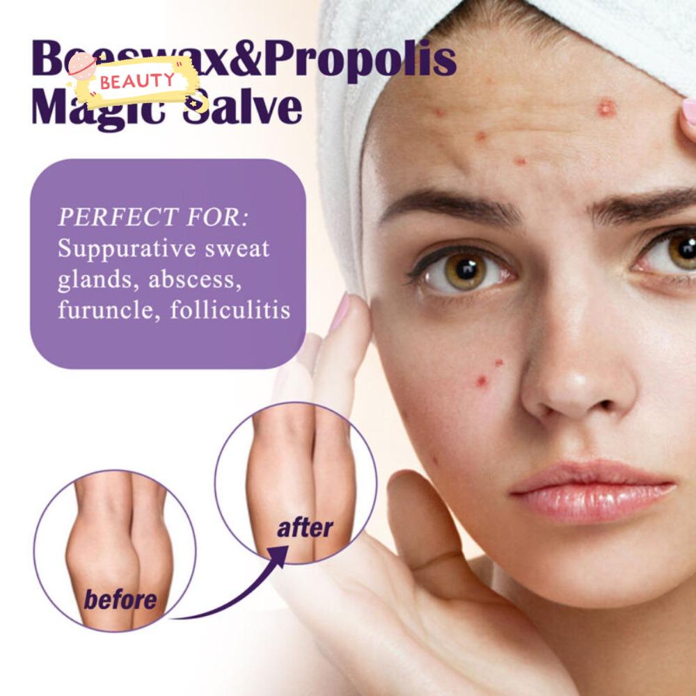 Keo Ong Chúa Chăm Sóc Da Mặt Dịu Nhẹ