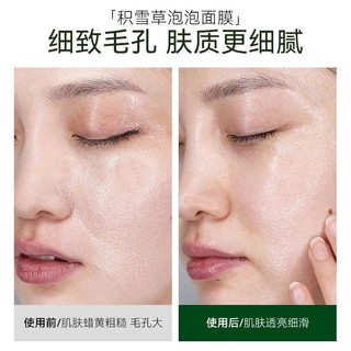 Bán Chạy Đặc Biệt#现货积雪草微酸小气泡面膜去黑头去粉刺深层清洁收缩毛孔闭口泥膜正品#正品7. 25yy