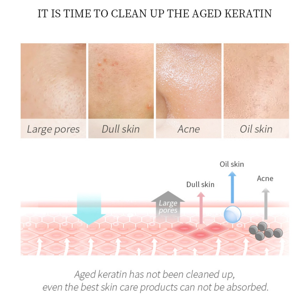 Gel Trà Xanh LAIKOU Tẩy Tế Bào Chết Dưỡng Ẩm Làm Trắng Da