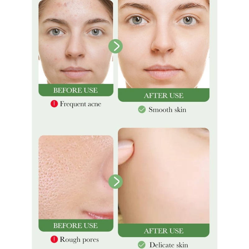 Sữa Rửa Mặt Bioaqua 100g Làm Sạch Sâu Lỗ Chân Lông Chăm Sóc Da