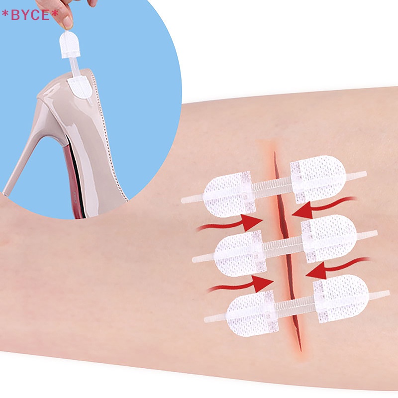 Byce &gt; Miếng Vá Vết Thương Có Dây Kéo Mới