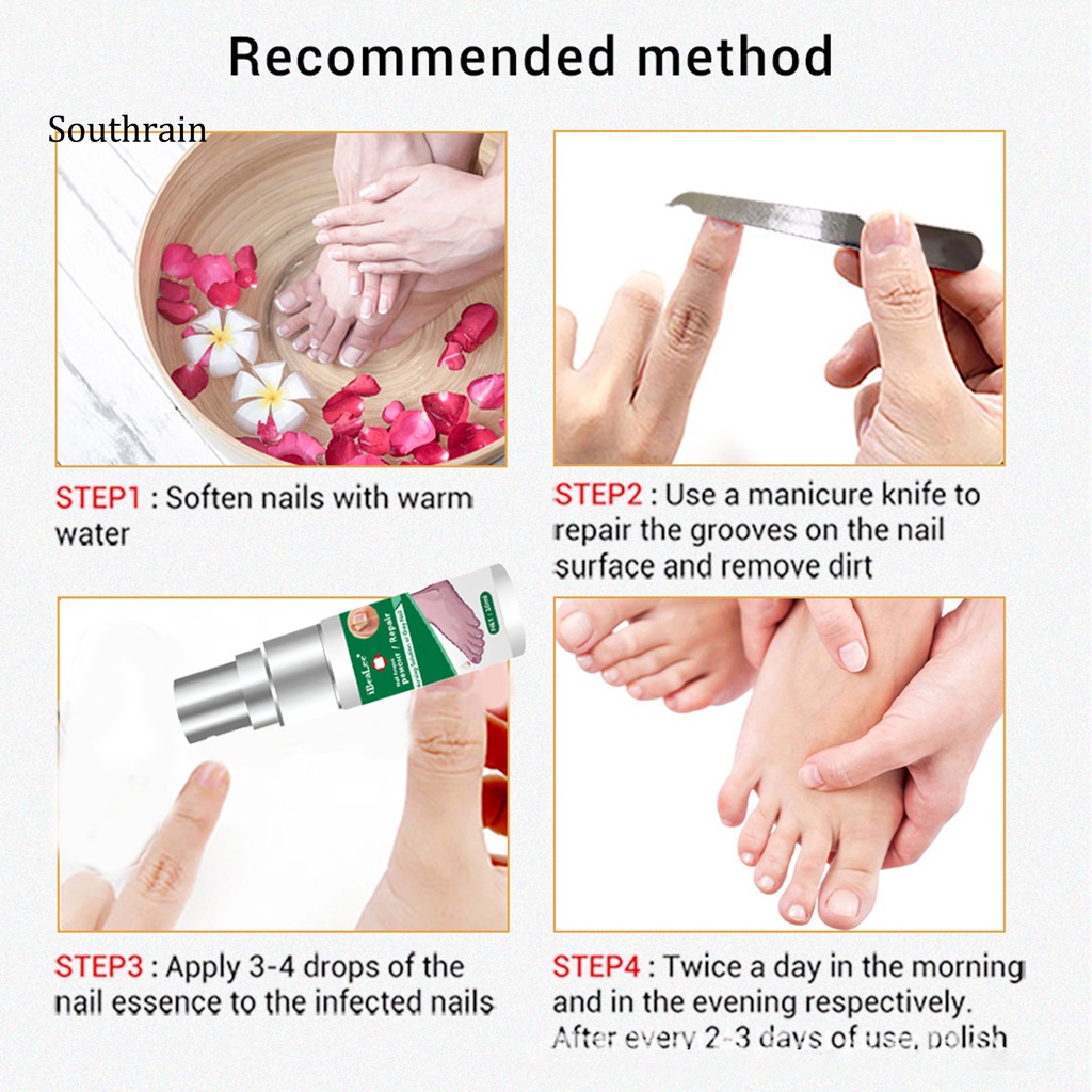 Dung Dịch Kháng Khuẩn 10ml Dễ Sử Dụng Cho Chăm Sóc Móng Tại Nhà