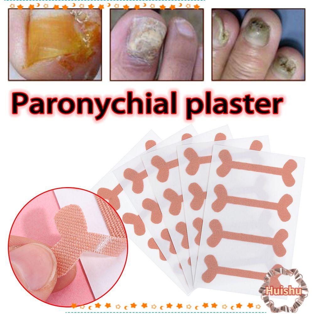 HS Miếng Dán Chỉnh Hình Móng Chân Chuyên Nghiệp
