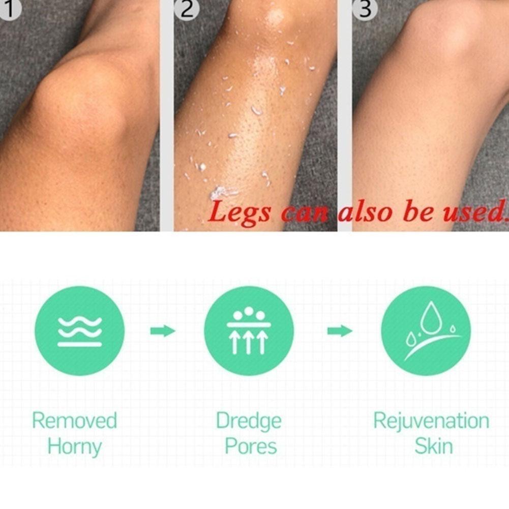 Gel Tẩy Tế Bào Chết Loại Bỏ Da Chết Cho Mặt Và Cơ Thể W4L3