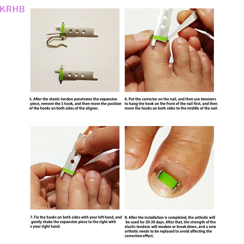 Dụng Cụ Chăm Sóc Móng Chân Chuyên Nghiệp Mới