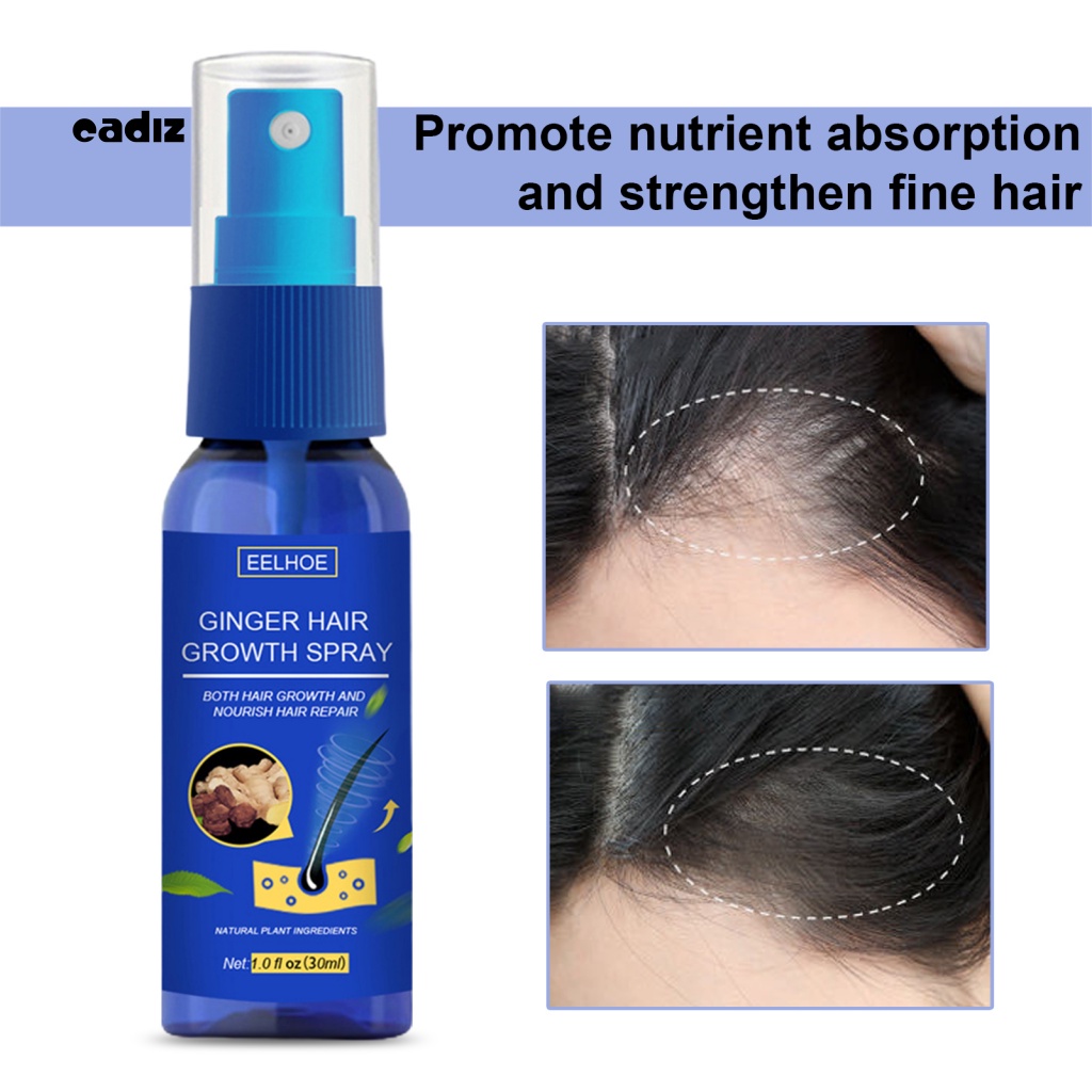 Chai Xịt Giúp Tóc Mọc Nhanh Chiết Xuất Gừng Tự Nhiên 30ML