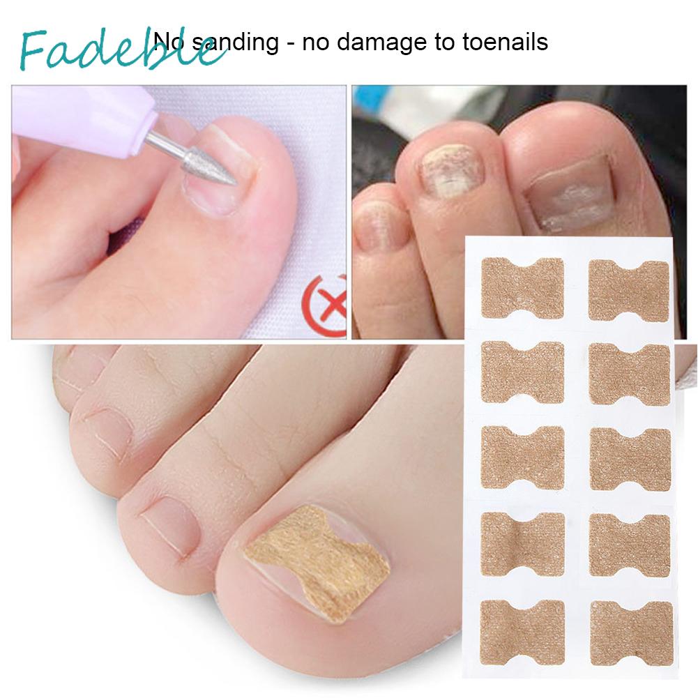 Set 10 Miếng Dán Chỉnh Sửa Móng Chân Tiện Dụng