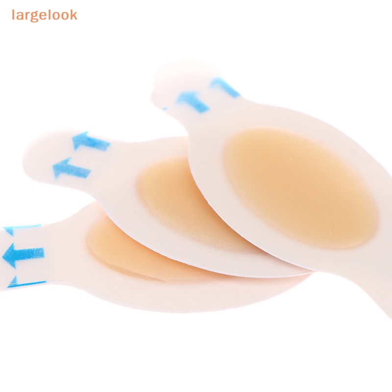Set 4 Miếng Dán Thạch Cao Hydrocolloid Chống Mòn Chăm Sóc Bàn Chân