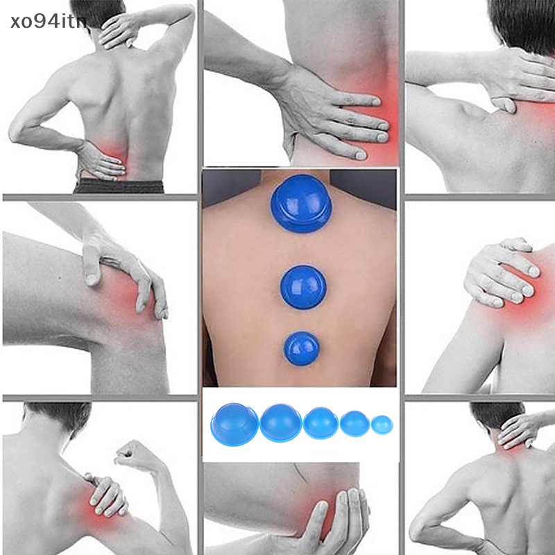 Bộ 12 Cốc Silicone Mát Xa Chân Không Chống Cellulite