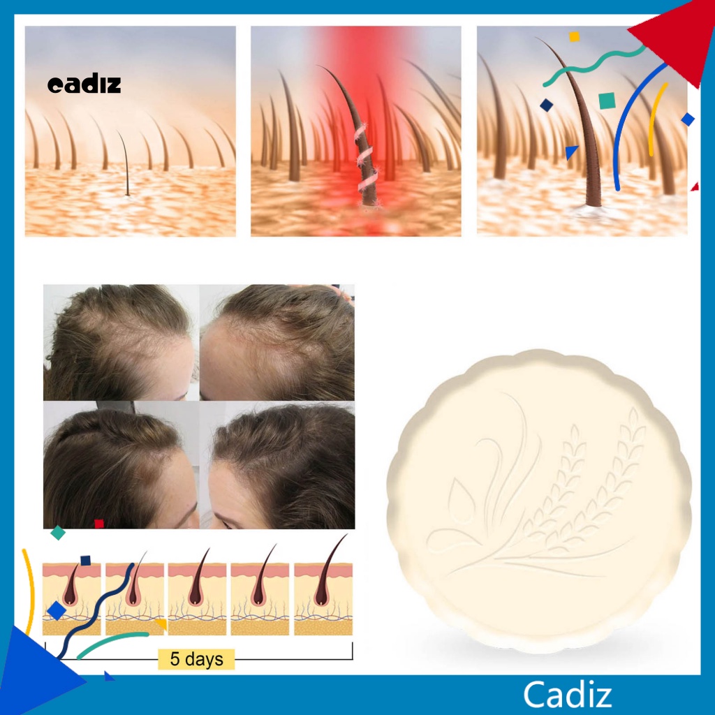 Xà Phòng Gội Đầu Chống Rụng Tóc Nhanh Chóng Không Gây Kích Ứng Cho Người Lớn