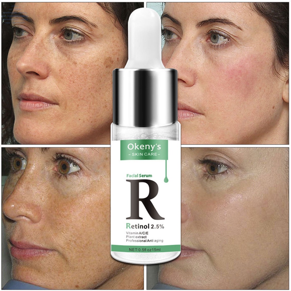 Tinh Chất Retinol 2.5% Retinol Vitamin A / C / E Làm Trắng Da Chống Lão Hóa Loại Bỏ Đốm Đen Và Nếp Nhăn 15ml