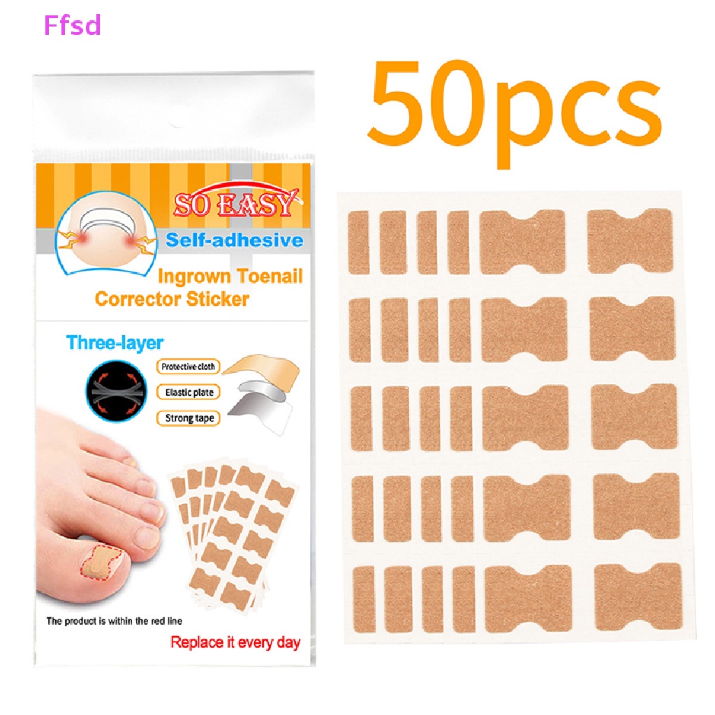 Set 50 Miếng Dán Chỉnh Sửa Móng Chân Mọc Ngược Tiện Dụng