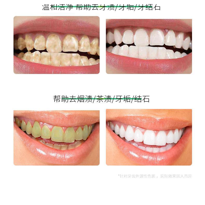 Qianmuduo toothpaste flagship store genuine Zhen Bai gingiva brightening White halitosis for men and women 120g official website TL