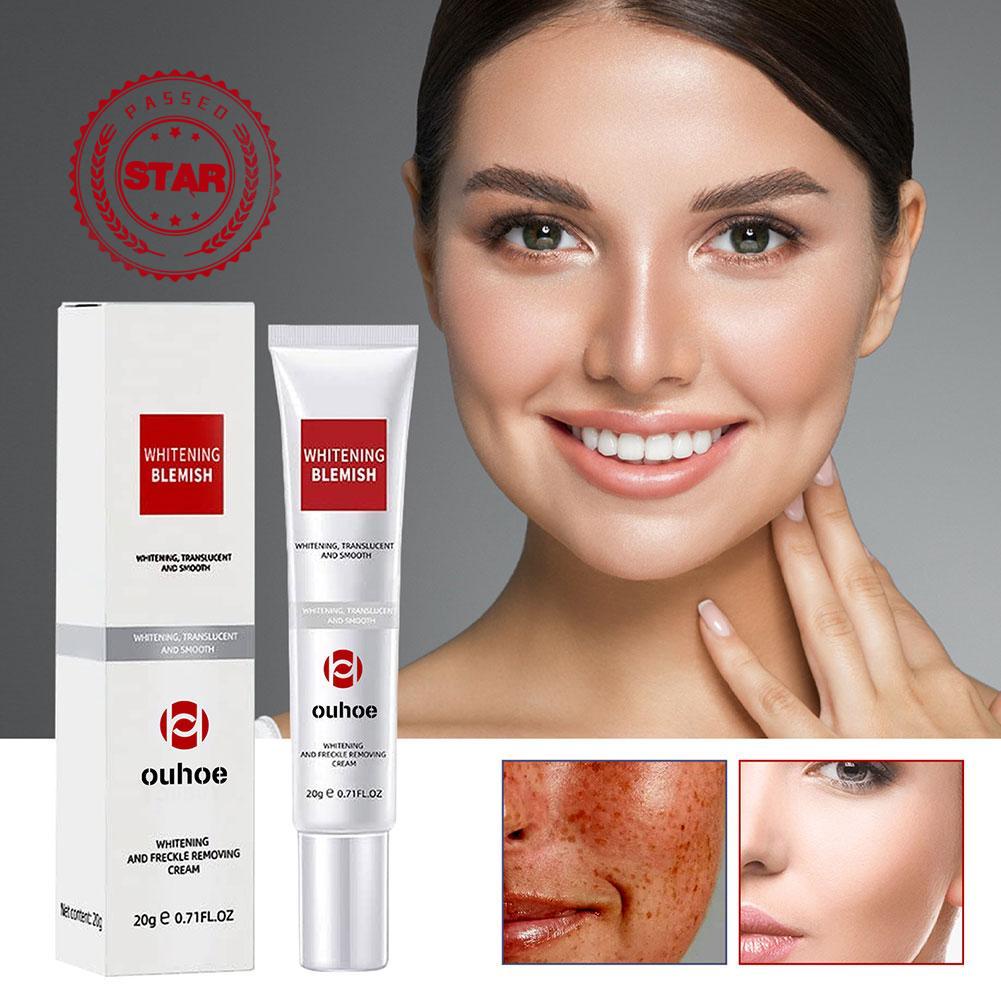 Kem Hỗ trợ giảm tàn nhang Và Đốm Đen Làm Sáng Da Y2U8