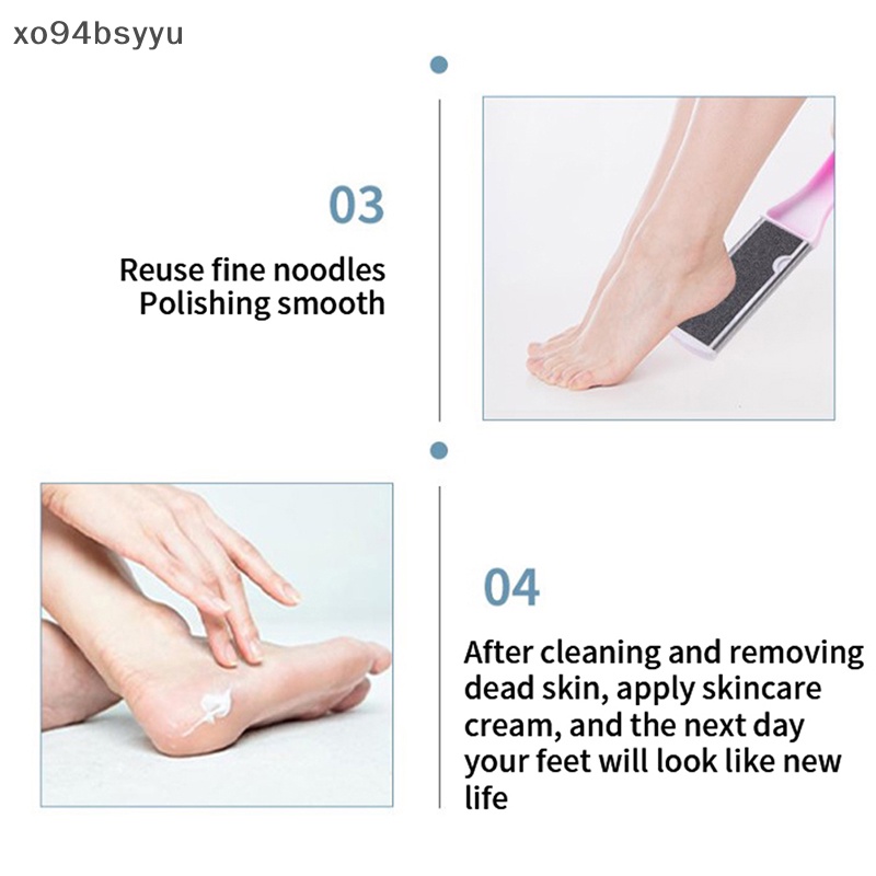 Dụng Cụ Dũa Loại Bỏ Da Chết Cho Bàn Chân Xo94Bsyu