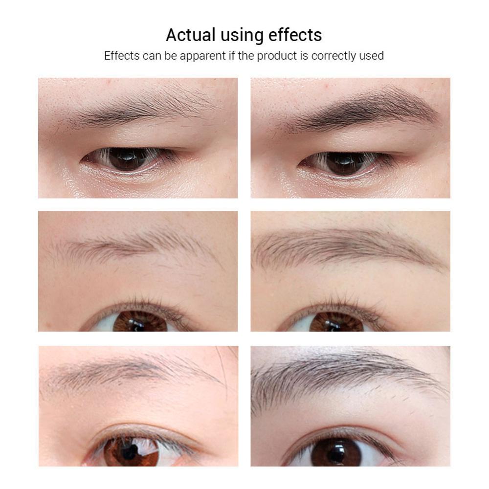 Serum Kích Thích Mọc Lông Mày Phát Triển Dạng Lỏng I8Z7