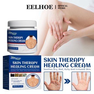 Kem chữa chàm vẩy nến EELHOE hợp chất thảo dược Trung Quốc giảm đỏ 20g