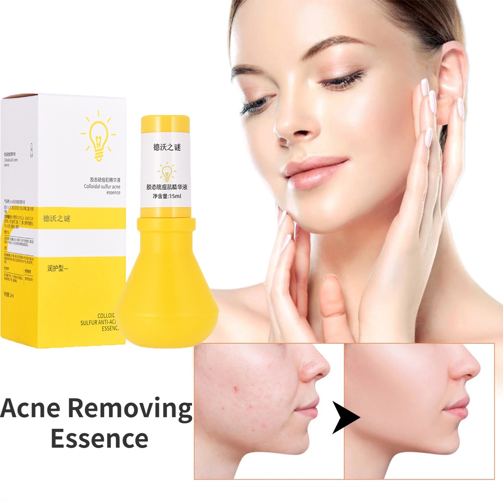 Tinh Chất Dưỡng Ẩm Kiểm Soát Dầu Thu Nhỏ Lỗ Chân Lông Làm Sáng Da 15ml