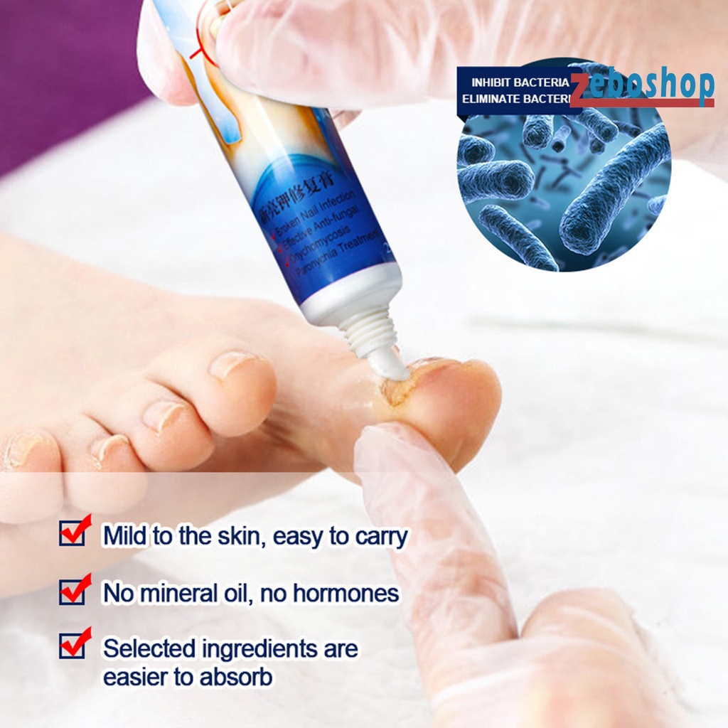 Kem Hỗ Trợ Giảm Nấm Móng 20g Thành Phần Tự Nhiên