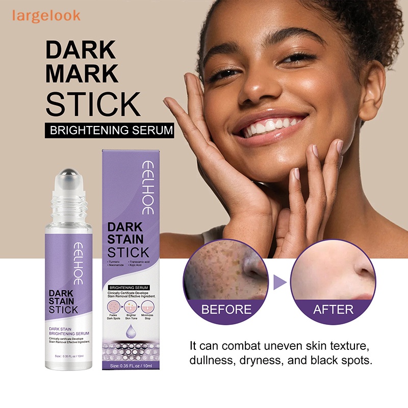 Cây Lăn Loại Bỏ Đốm Đen Làm Sáng Da Mặt 10ml