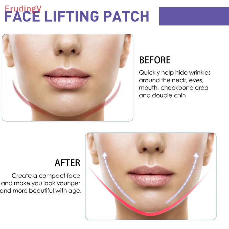 Băng Dán Nâng Cơ Mặt Vô Hình Tạo Khuôn Mặt Chữ V