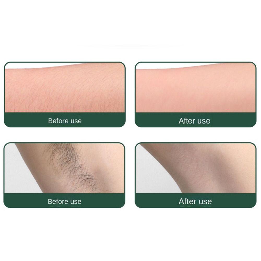 Dụng Cụ Tẩy Tế Bào Chết Nano Không Đau Cho Bàn Chân