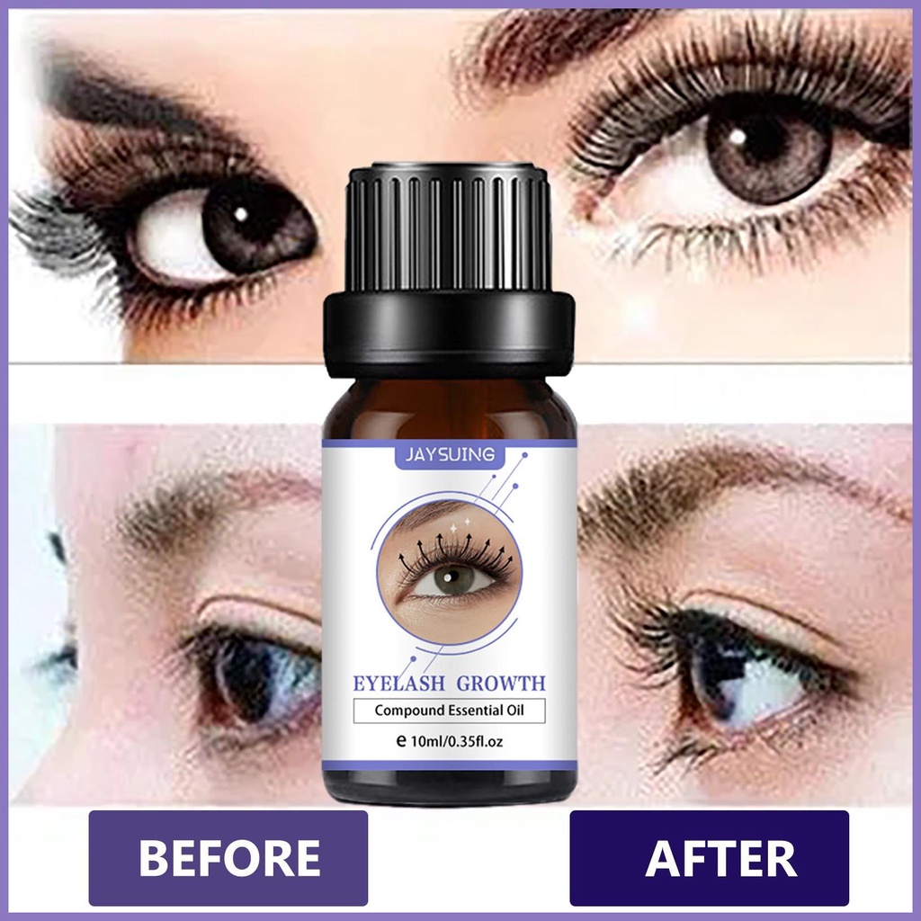 Serum Kích Thích Mọc Lông Mi Và Lông Mày Phát Triển Dày Hơn Hiệu Quả nota2vn