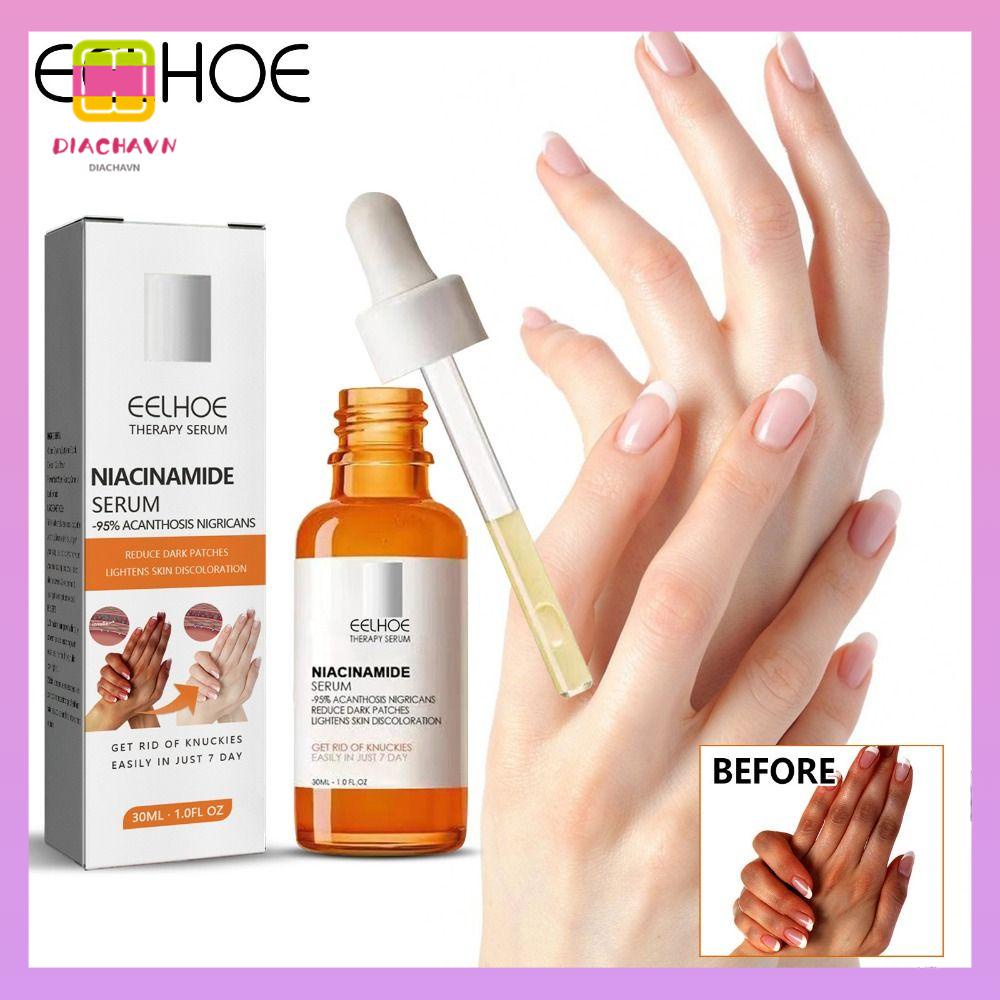 DIACHAVN Tinh Chất Acanthosis Nigricans Dưỡng Trắng Vùng Da Dưới Cánh Tay Và Toàn Thân