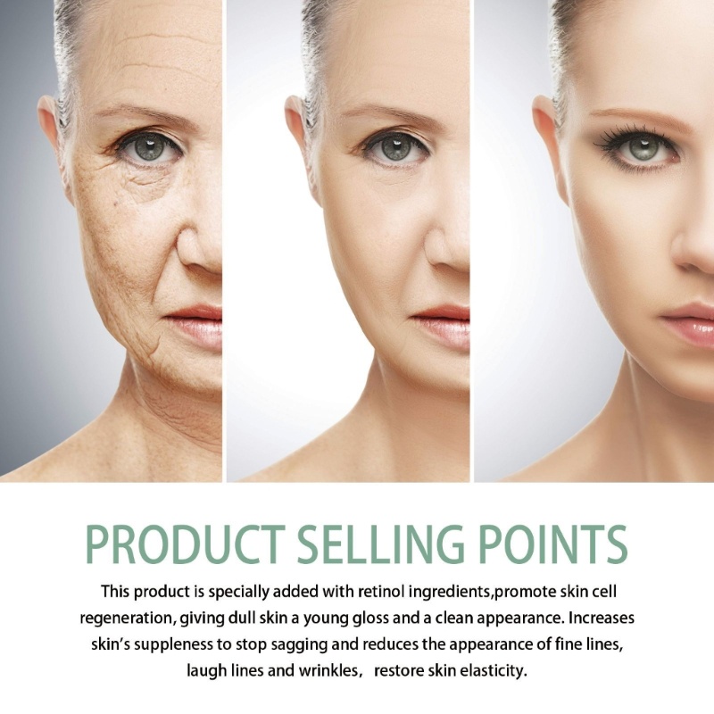 Kem Dưỡng Da Mặt Ban Đêm YOUYO Retinol Chống Lão Hóa Dưỡng Ẩm Loại Bỏ Nếp Nhăn Làm Sáng Da