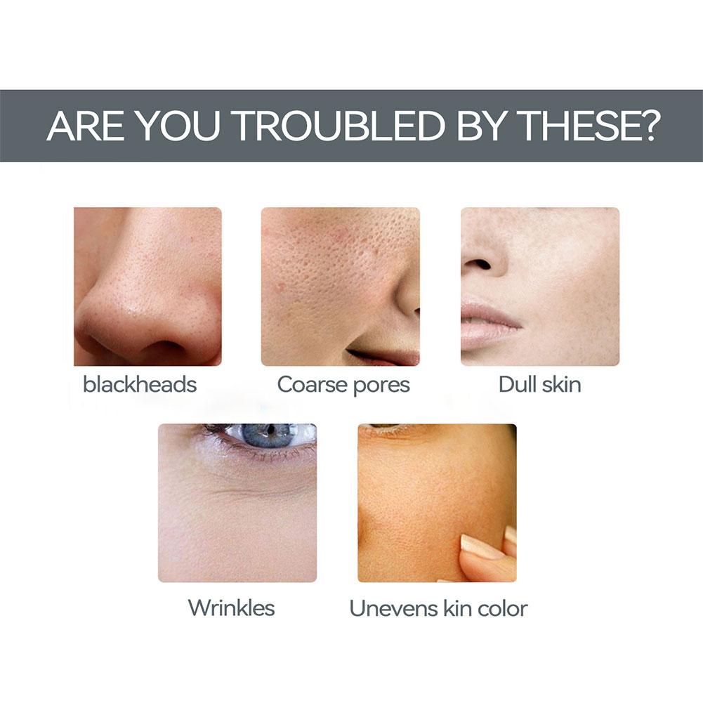 Kem Collagen Nâng Cơ Mặt Chống Nếp Nhăn Chăm Sóc Da P4U5