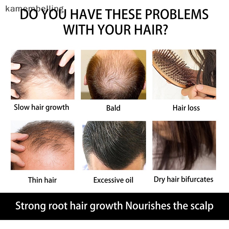 Con Lăn Mát Xa kamembelling Kích Thích Mọc Tóc Và Râu