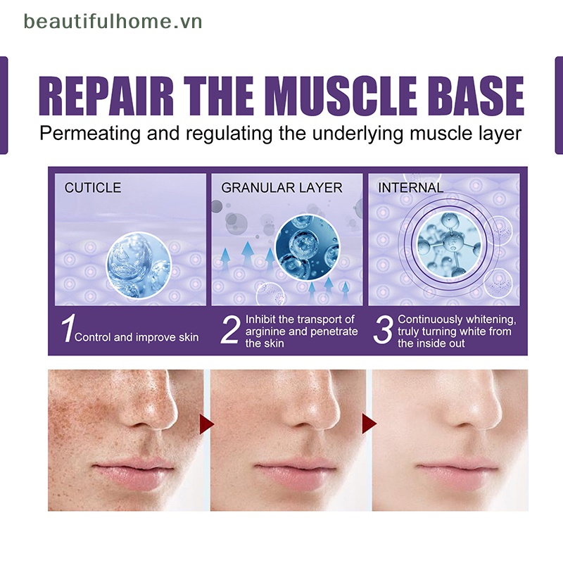 Thanh Lăn Loại Bỏ Đốm Đen Làm Sáng Da Mặt 10ml