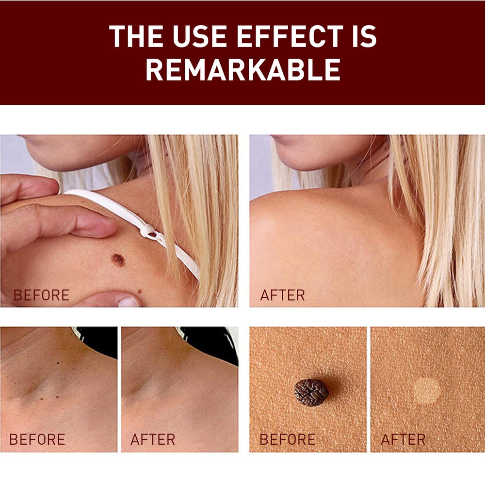 Bút Làm Sạch Sâu Chăm Sóc Da Mặt Và Toàn Thân