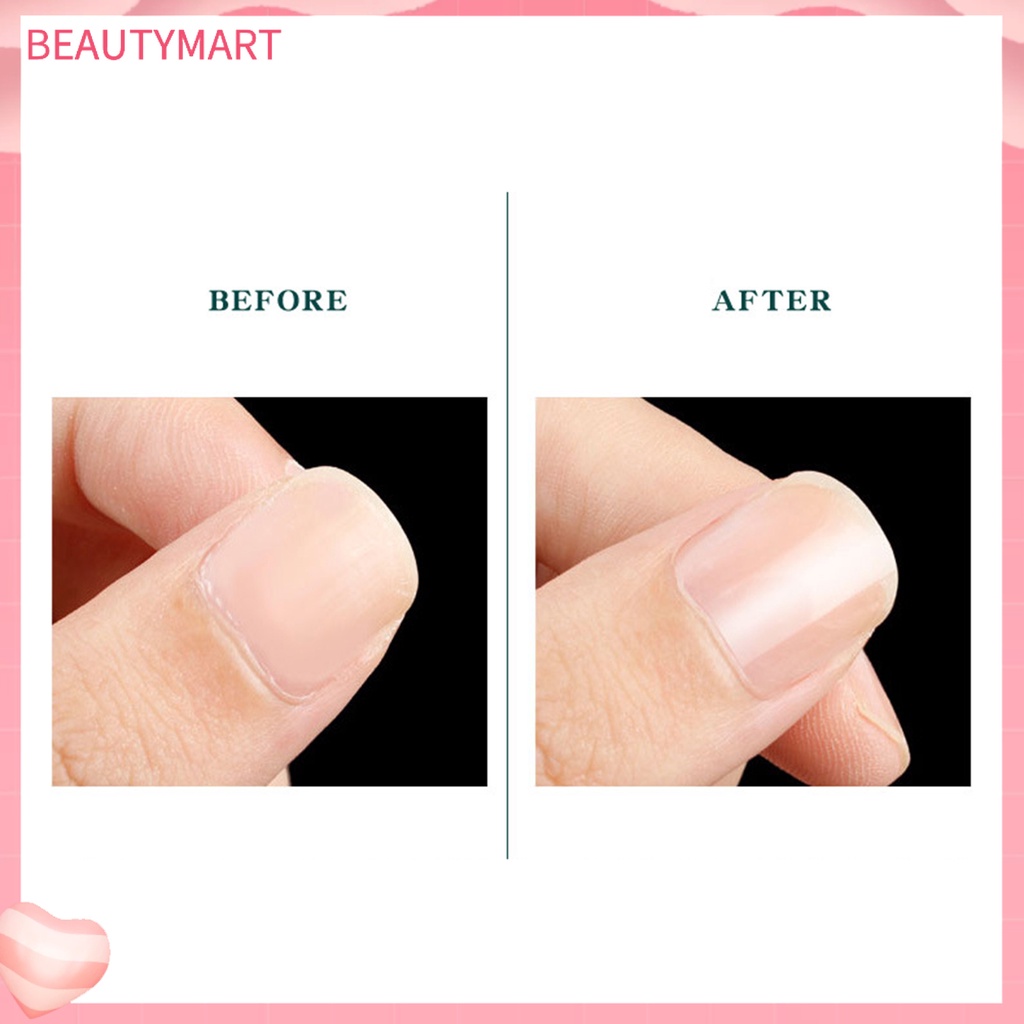 Hộp 6 Cây Dũa Móng Tay Bằng Nhựa PP Dành Cho Nữ