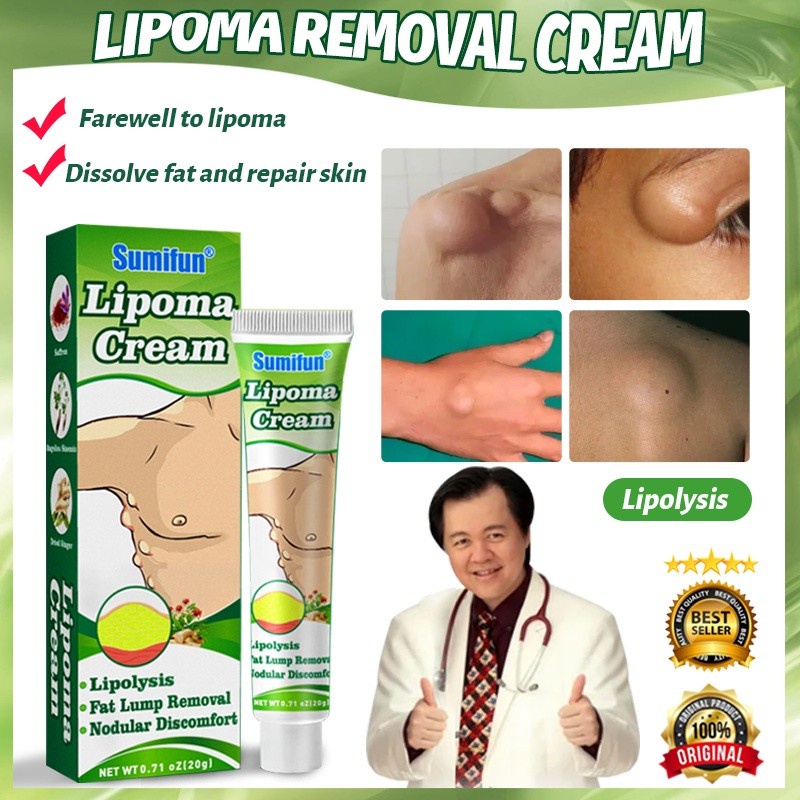 Kem Loại Bỏ Lipoma, Kem Lipoma Loại Bỏ Nhiều Loại Bỏ Dưới Da Đơn Khối Phồng Loại Bỏ Lipoma Nhanh Beautysecret1 beautysecret1