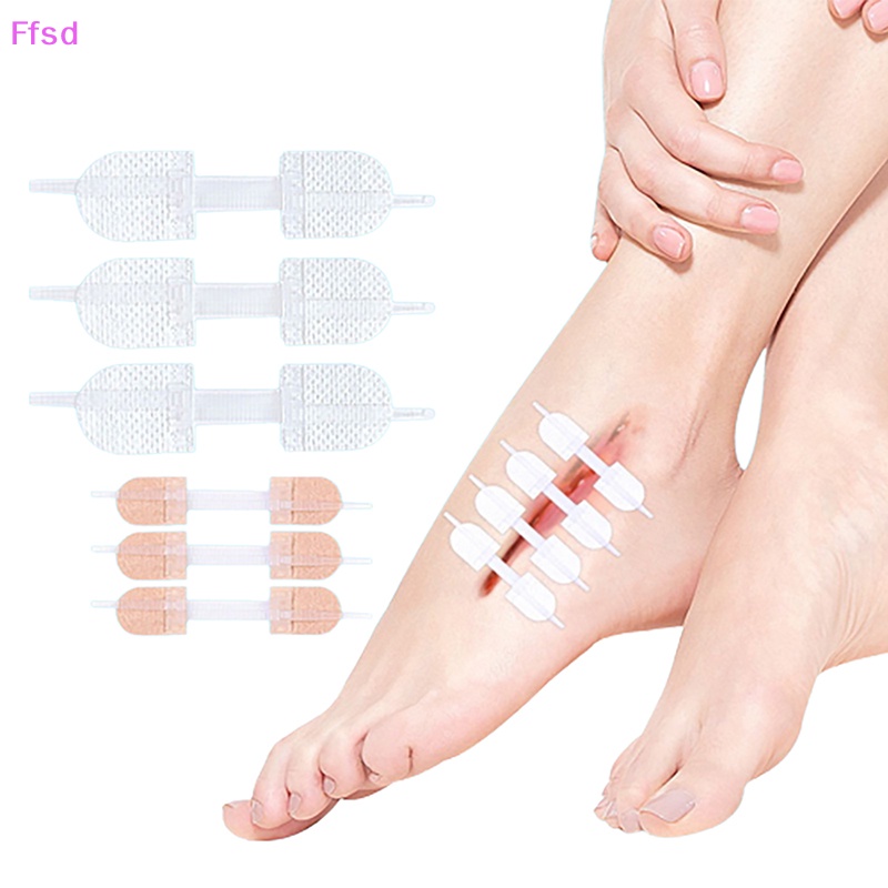 {Ffsd} Miếng Vá Vết Thương Khóa Kéo Tĩnh Điện Nhanh Chóng * Bán Chạy