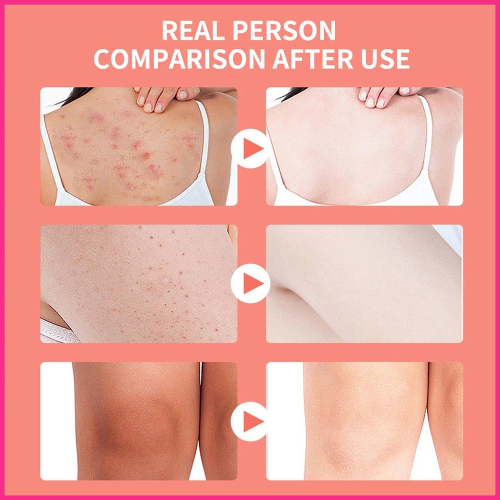 Muối Hồng Himalaya Tẩy Tế Bào Chết Tự Nhiên Dưỡng Ẩm Làm Sạch Sâu Cho Da