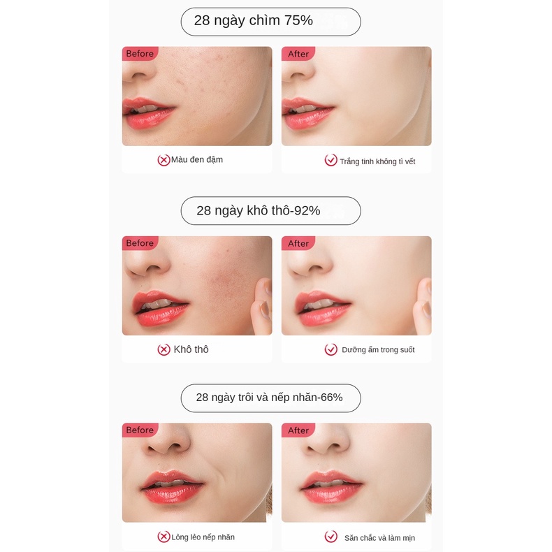 Tinh Dầu Dưỡng Ẩm Làm Trắng Da Mờ Vết Thâm 40ml