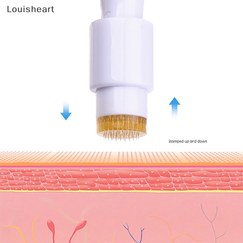Louisheart 40a titanium alloy micro derma stamp có thể điều chỉnh để chăm sóc da mặt điều Hỗ trợ giảm mụn trứng cá cải thiện nếp nhăn công cụ làm đẹp tfg