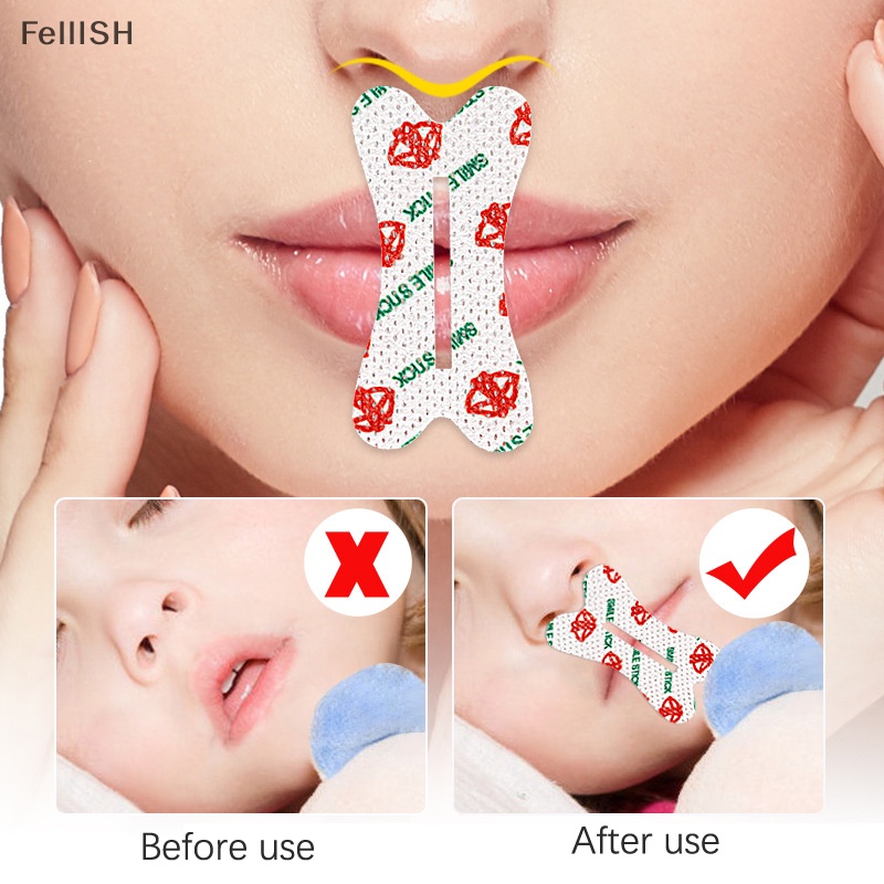 Set 30 Miếng Dán Mũi / Môi Chống Ngáy Khi Ngủ Mã 439br