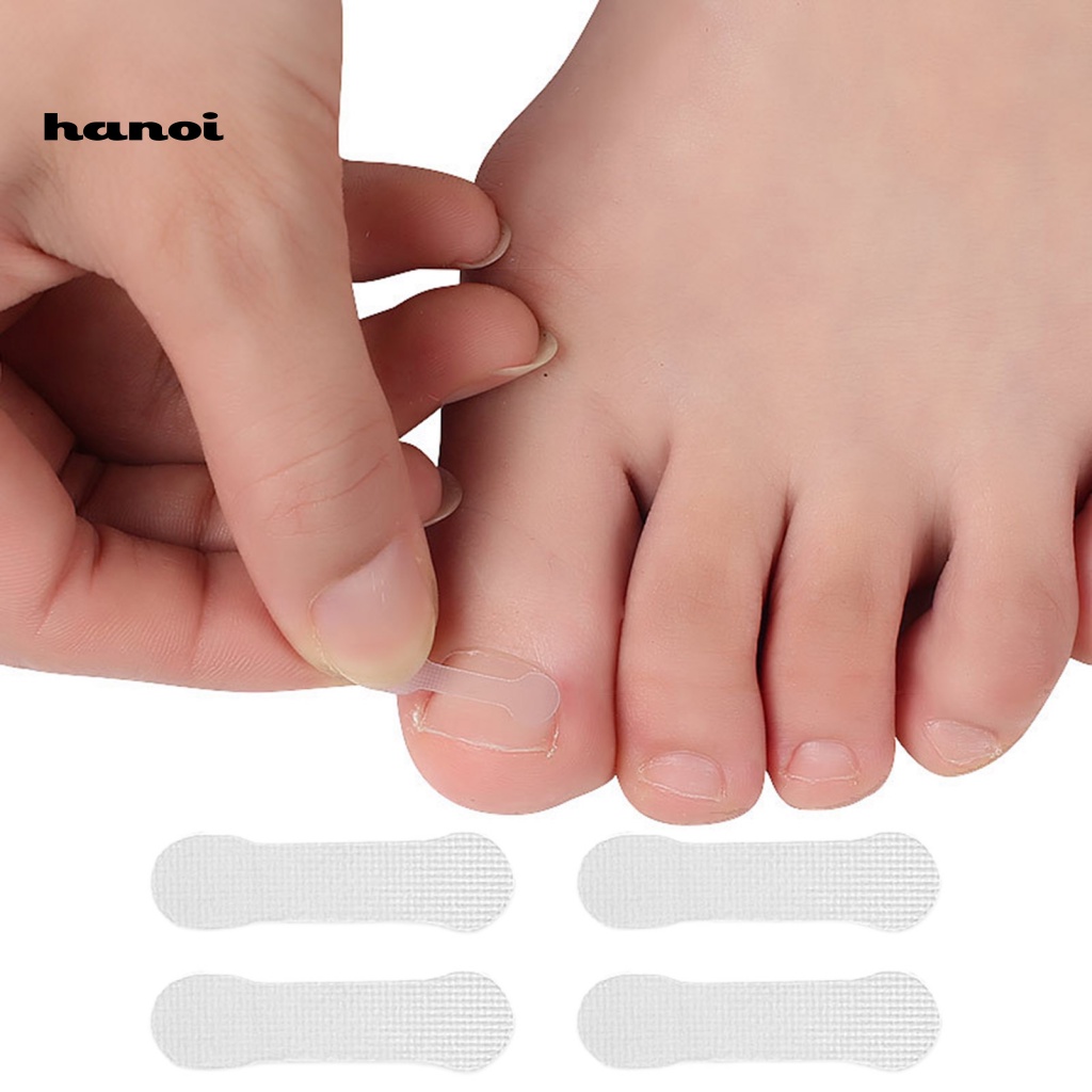 Hộp 10 Miếng Dán Chỉnh Sửa Móng Chân Nhanh Chóng Tiện Lợi