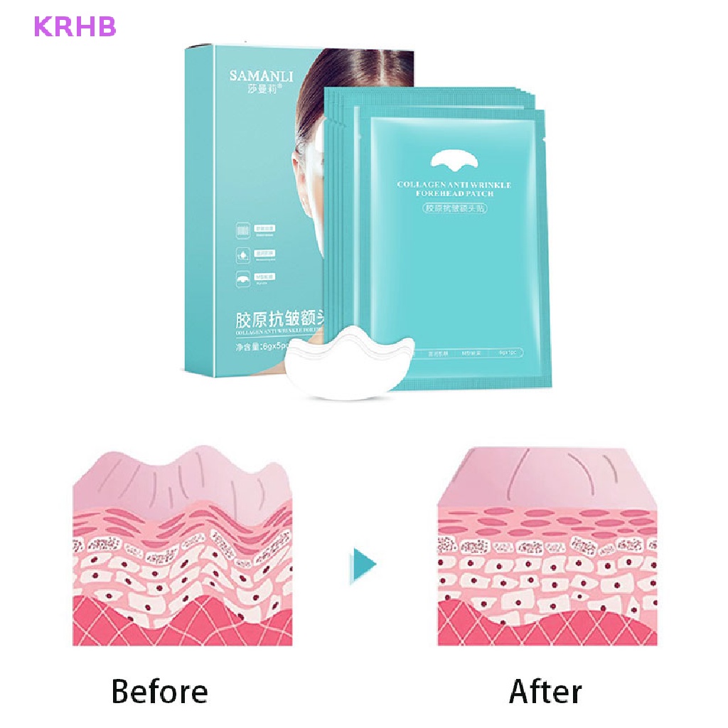 Bộ 5 Miếng Dán Dưỡng Ẩm Chống Nếp Nhăn Và Lão Hóa Cho Vùng Da Trán