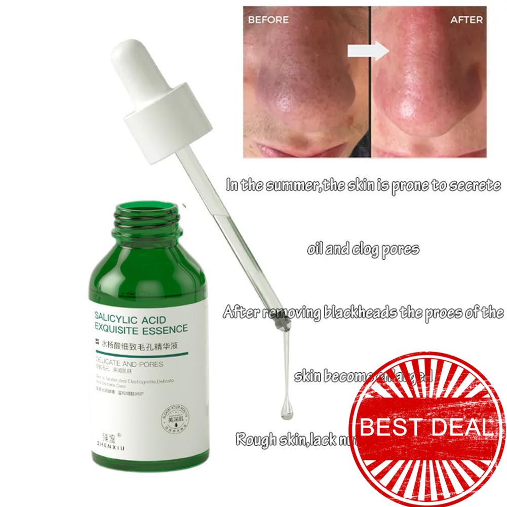 Tinh Chất Salicylic Acid 30ml Dưỡng Ẩm Thu Nhỏ Lỗ Chân Lông Loại Bỏ Mụn Đầu Đen L9M8