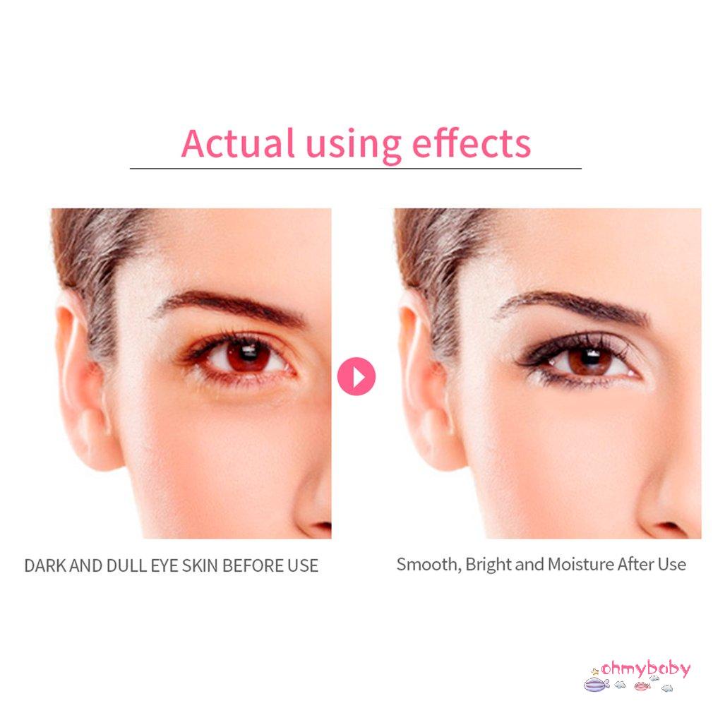 [InStock] 1 Đôi Hoa Hồng Mặt Nạ Mắt Giảm Nếp Nhăn Bọng Quầng Thâm Áp Lực Túi Chống Lão Hóa Dưới Miếng Dán [Z/13]