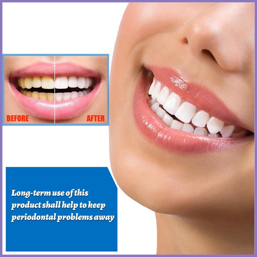 Tinh Chất Làm Trắng Răng Loại Bỏ Vết Bẩn Trên Răng Ngăn Ngừa Caries Tươi Mới nota2vn