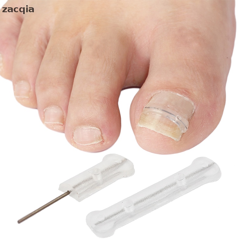 Set 10 Miếng Dán Chỉnh Sửa Móng Chân 13-20mm Tiện Dụng