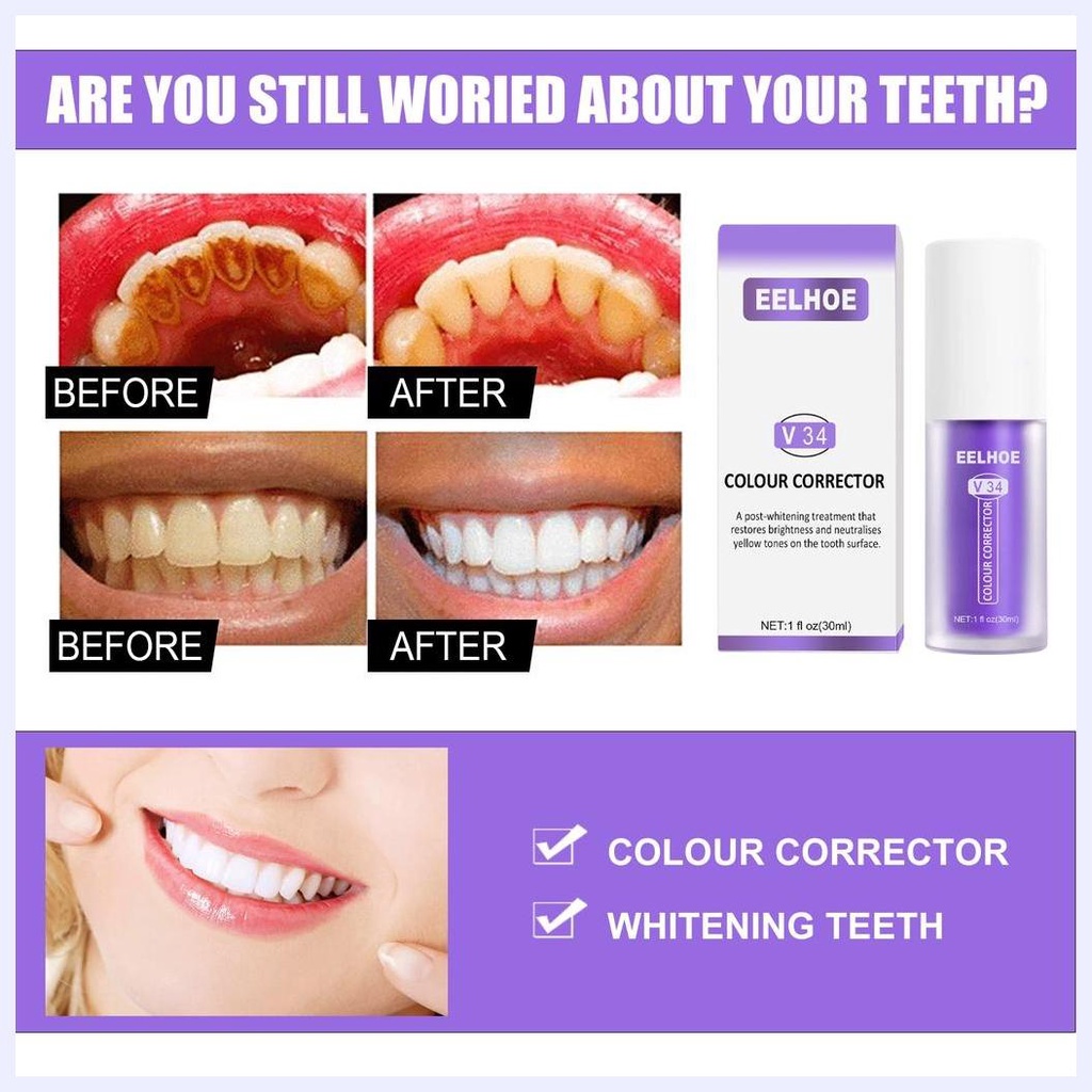 Kem Đánh Răng SMILEKIT / ALIVER / Eelhoe / Hismile Làm Trắng Răng V34 Chống Nhạy Cảm