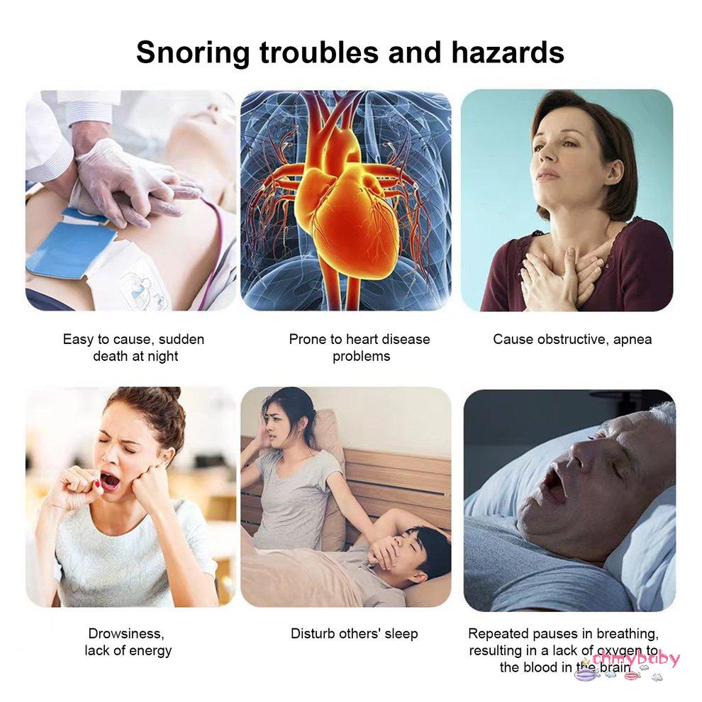 [Sẵn sàng] Thiết Bị Chống Ngáy Thông Minh Xung Ems Giảm Tiếng Ồn Máy Kích Thích Cơ Hơi Thở Ngủ Thoải Mái Hỗ Trợ Chăm Sóc Sức Khỏe Chặn [P/3]