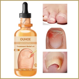 Tinh chất phục hồi móng hư tổn 0.35oz